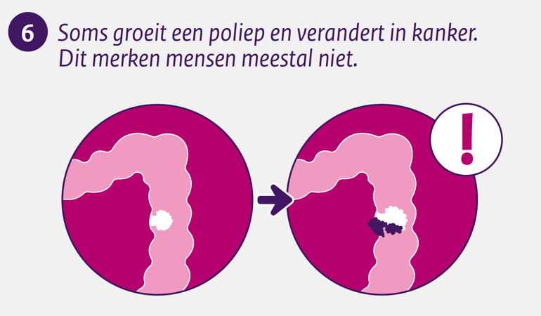Soms groeit een poliep en verandert in kanker. Dit merken mensen meestal niet.
