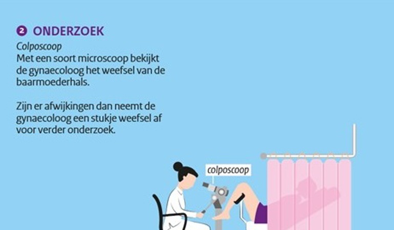 Met een soort microscoop bekijkt de gynaecoloog het weefsel van de baarmoederhals. Zijn er afwijkingen dan neemt de gynaecoloog een stukje weefsel af voor verder onderzoek. 